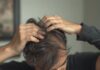 What exactly is dandruff? Most people are unaware of the truth